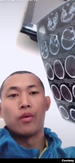 前中國“精神病監獄”受害者界立建2018年第三度遭精神病監禁後，出院後照的CT片。(照片提供：界立建)