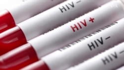 مهار اچ‌آی‌وی؛ گام‌های تازه در ایران و دستاوردهای نو در امریکا