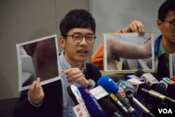 香港眾志主席羅冠聰展示遇襲傷痕的照片。(美國之音湯惠芸攝）
