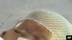 被車碾壓的幼童小悅悅在病床上