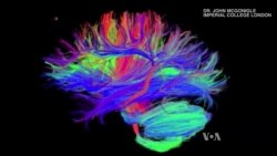 Researchers Find Link Between Brain Health, Aging