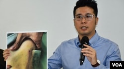 香港民權觀察成員王浩賢呼籲港府就警方6-12清場行動成立獨立調查委員會。(美國之音湯惠芸拍攝)