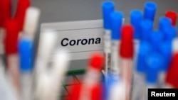 德國科隆一家醫學實驗室的冠狀病毒檢測試劑。（2020年3月24日）