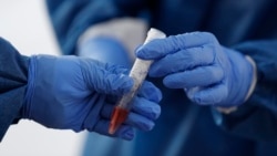 ການທົດສອບໃໝ່ທີ່ພັດທະນາຢູ່ມະ​ຫາ​ວິ​ທະ​ຍາ​ໄລ UCLA ຈະເປັນການປ່ຽນແປງເກມ ໃນການວິນິດໄສວັນນະໂລກ