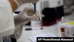 化驗人員檢測血液樣本