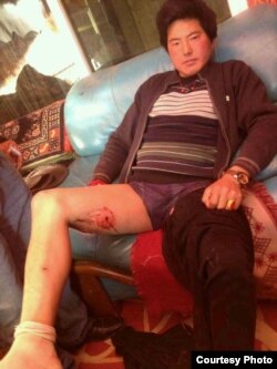 藏族青年丹正(Tamdin)在甘孜州炉霍县因进行宗教仪式遭到警察枪击，子弹击中右侧大腿。（图片由自由西藏运动提供）