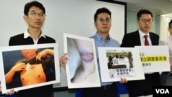 香港民權觀察、國際特赦組織香港分會代表，展示6-12警方清場行動中受傷的示威者傷勢照片，證警方使用過度武力。(美國之音湯惠芸攝）