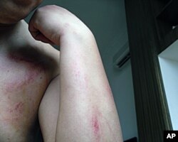 刘飞跃挨打受伤