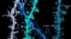 3D images of synapses that shrink during sleep. Credit: Wisconsin Center for Sleep and Consciousness