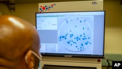 德班的非洲健康研究院研究人员赛勒2021年12月15日在研究新型冠状病毒奥密克戎毒株