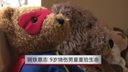 钢铁意志 9岁烧伤男童重拾生命