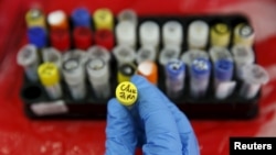 實驗室人員分析血液樣本