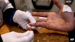 乌克兰医生为一位吸毒者做HIV艾滋病毒检验